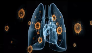 面對來勢洶洶的新型肺炎，我們該怎么預防？